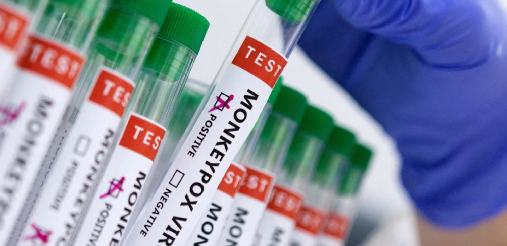 Ada 2.567 Kasus Cacar Monyet, China Gercep Bikin Vaksin Mpox